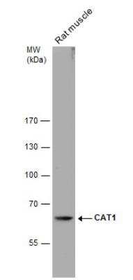 Western Blot: CRAT Antibody [NBP1-32108] - Rat tissue extract (50 ug) was separated by 7.5% SDS-PAGE, and the membrane was blotted with CAT1 antibody  diluted at 1:500.