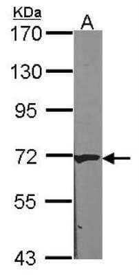 Western Blot: CRAT Antibody [NBP2-15999] - Sample (30 ug of whole cell lysate) A: 293T 7. 5% SDS PAGE gel, diluted at 1:1000.