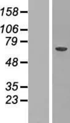 Western Blot CRAT Overexpression Lysate