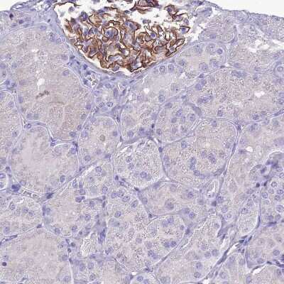 Immunohistochemistry-Paraffin: CRB2 Antibody [NBP1-91809] - Staining of human Kidney shows strong membranous positivity in cells in glomeruli.