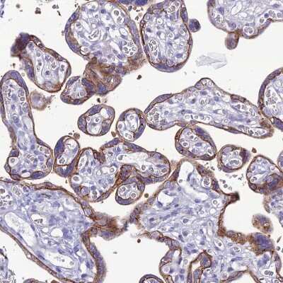 Immunohistochemistry-Paraffin: CRB2 Antibody [NBP1-91809] - Staining of human Placenta shows strong membranous positivity in trophoblastic cells.