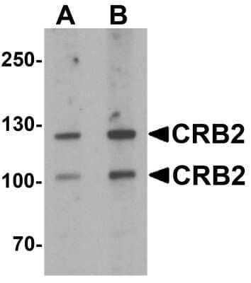 Western Blot: CRB2 Antibody [NBP2-81710] - Western blot analysis of CRB2 in rat brain tissue lysate with CRB2 antibody at (A) 0.5 and (B) 1 ug/mL