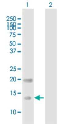 Western Blot CRB3 Antibody