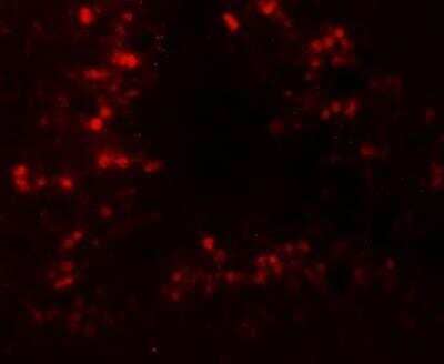 Immunocytochemistry/Immunofluorescence: CRBN Antibody [NBP2-82079] - Immunofluorescence of CRBN in rat testis tissue with CRBN antibody at 20 ug/mL.