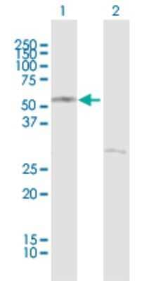 Western Blot CRBN Antibody