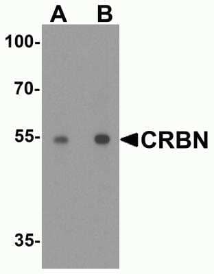 Western Blot: CRBN Antibody [NBP2-82079] - Analysis of CRBN in human testis tissue lysate with CRBN antibody at (A) 0.5 and (B) 1 ug/ml.