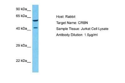 Western Blot: CRBN Antibody [NBP2-87207] - Host: Rabbit. Target Name: CRBN. Sample Type: Jurkat Whole Cell lysates. Antibody Dilution: 1.0ug/ml