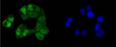 Immunocytochemistry/Immunofluorescence: CREB Antibody (SA04-04) [NBP2-67274] - Staining CREB in Hela cells (green). The nuclear counter stain is DAPI (blue). Cells were fixed in paraformaldehyde, permeabilised with 0.25% Triton X100/PBS.