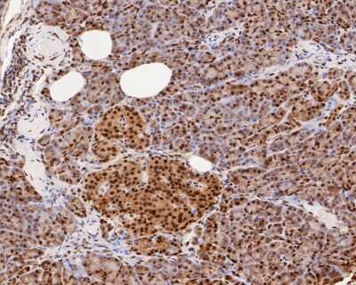 Immunohistochemistry-Paraffin: CREB Antibody (SA04-04) [NBP2-67274] - Immunohistochemical analysis of paraffin-embedded human pancreas tissue using anti-CREB antibody. The section was pre-treated using heat mediated antigen retrieval with sodium citrate buffer (pH 6.0) for 20 minutes. The tissues were blocked in 5% BSA for