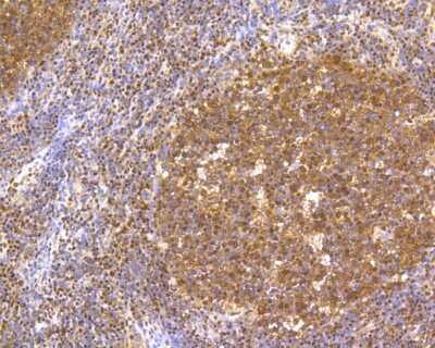 Immunohistochemistry-Paraffin: CREB Antibody (SA04-04) [NBP2-67274] - Immunohistochemical analysis of paraffin-embedded human tonsil tissue using anti-CREB antibody. The section was pre-treated using heat mediated antigen retrieval with Tris-EDTA buffer (pH 8.0-8.4) for 20 minutes. The tissues were blocked in 5% BSA for 30