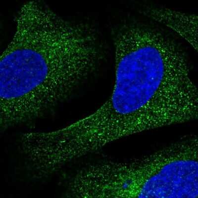 Immunocytochemistry/Immunofluorescence: CREB3 Antibody [NBP2-58307] - Staining of human cell line U-2 OS shows localization to cytosol. Antibody staining is shown in green.