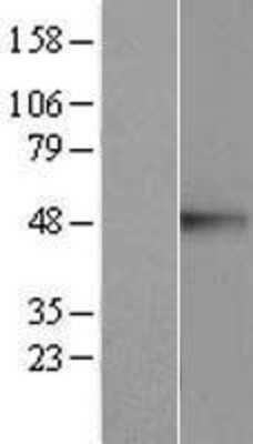 Western Blot: CREB3 Overexpression Lysate (Adult Normal) [NBP2-07628] Left-Empty vector transfected control cell lysate (HEK293 cell lysate); Right -Over-expression Lysate for CREB3.