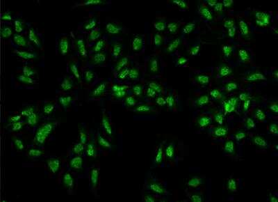 Immunocytochemistry/Immunofluorescence: CREB3 regulatory factor Antibody [NBP3-06573] - Staining of CREBRF in U2OS cells. Cells were fixed with 4% PFA, permeabilzed with 0.3% Triton X-100 in PBS,blocked with 10% serum, and incubated with rabbit anti-Human CREBRF polyclonal antibody (dilution ratio 1:100) at 4? overnight. Then cells were stained with the Alexa Fluor®488-conjugated Goat Anti-rabbit IgG secondary antibody (green). Positive staining was localized to Nucleus.