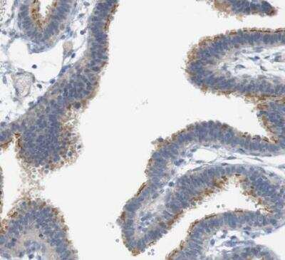 Immunohistochemistry-Paraffin: CREB3L2 Antibody [NBP1-88697] - Staining of human fallopian tube shows moderate cytoplasmic positivity in glandular cells.