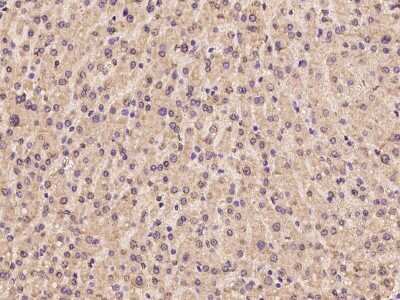 Immunohistochemistry-Paraffin: CREB3L2 Antibody [NBP2-97960] - Immunochemical staining of human CREB3L2 in human liver with rabbit polyclonal antibody at 1:100 dilution, formalin-fixed paraffin embedded sections.