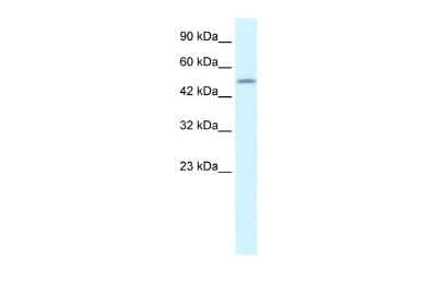Western Blot: CREB3L2 Antibody [NBP2-87208] - WB Suggested Anti-CREB3L2 Antibody Titration: 1.25ug/ml. ELISA Titer: 1:12500. Positive Control: Jurkat cell lysate