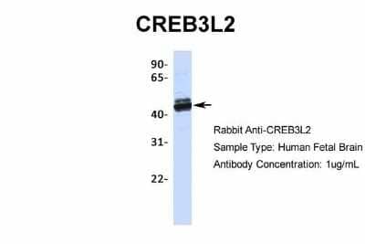 Western Blot: CREB3L2 Antibody [NBP2-87208] - Host: Rabbit. Target Name: CREB3L2. Sample Type: Human Fetal Brain. Antibody Dilution: 1.0ug/ml