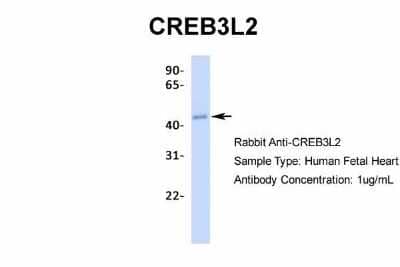 Western Blot: CREB3L2 Antibody [NBP2-87208] - Host: Rabbit. Target Name: CREB3L2. Sample Type: Human Fetal Heart. Antibody Dilution: 1.0ug/ml