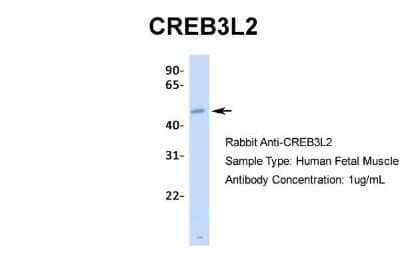 Western Blot: CREB3L2 Antibody [NBP2-87208] - Host: Rabbit. Target Name: CREB3L2. Sample Type: Human Fetal Muscle. Antibody Dilution: 1.0ug/ml