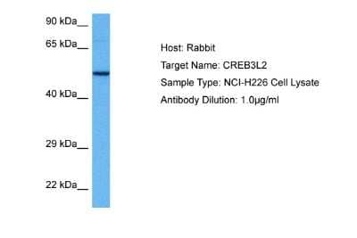 Western Blot: CREB3L2 Antibody [NBP2-87209] - Host: Rabbit. Target Name: CREB3L2. Sample Tissue: Human NCI-H226 Whole Cell lysates. Antibody Dilution: 1ug/ml
