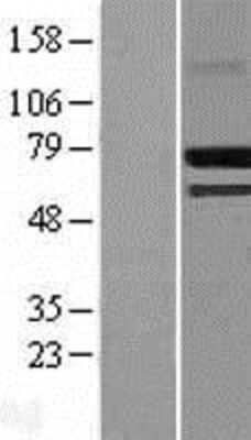 Western Blot: CREB3L2 Overexpression Lysate (Adult Normal) [NBL1-09465] Left-Empty vector transfected control cell lysate (HEK293 cell lysate); Right -Over-expression Lysate for CREB3L2.