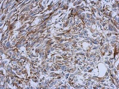 Immunohistochemistry-Paraffin: CREB3L3 Antibody [NBP2-16008] -  U251 xenograft, using CREB3L3 antibody at 1:500 dilution. Antigen Retrieval: Trilogy™ (EDTA based, pH 8.0) buffer, 15min.