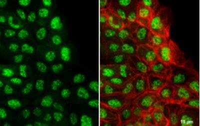 Immunohistochemistry-Paraffin: CREB3L3 Antibody [NBP2-16008] - A431 cells were fixed in 4% paraformaldehyde at RT for 15 min. Green: CREB3L3 stained by CREB3L3 antibody [N1C1] diluted at 1:500. Red: phalloidin, a cytoskeleton marker, diluted at 1:100. Scale bar= 10 um.