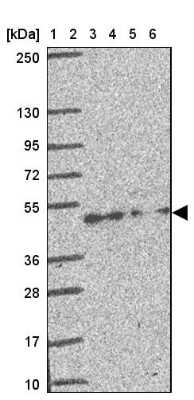 <b>Orthogonal Strategies Validation. </b>Western Blot: CREB3L3 Antibody [NBP2-38785] - Lane 1: Marker  [kDa] 250, 130, 95, 72, 55, 36, 28, 17, 10.  Lane 2: Human cell line RT-4.  Lane 3: Human cell line U-251MG.  Lane 4: Human Plasma.  Lane 5: Human liver tissue.  Lane 6: Human tonsil tissue
