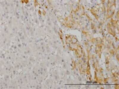 Immunohistochemistry-Paraffin: CREB5 Antibody (8A5) [H00009586-M02] - Analysis of monoclonal antibody to CREB5 on formalin-fixed paraffin-embedded human adrenal gland. Antibody concentration 1 ug/ml.