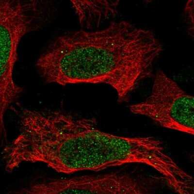 Immunocytochemistry/Immunofluorescence: CREB5 Antibody [NBP2-56627] - Staining of human cell line U-2 OS shows localization to nucleoplasm & vesicles.