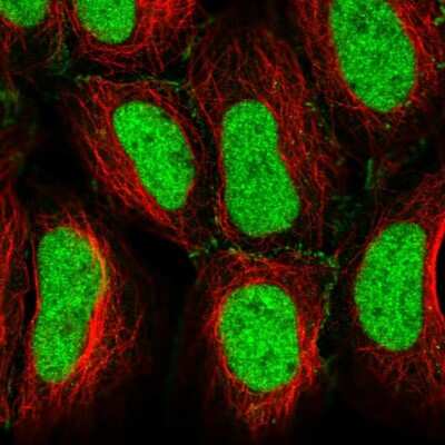 Immunocytochemistry/Immunofluorescence: CREB5 Antibody [NBP2-56912] - Staining of human cell line HEK 293 shows localization to nucleus & plasma membrane.