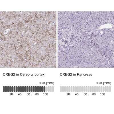 Immunohistochemistry-Paraffin: CREG2 Antibody [NBP1-86262] - Staining in human cerebral cortex and pancreas tissues using anti-CREG2 antibody. Corresponding CREG2 RNA-seq data are presented for the same tissues.