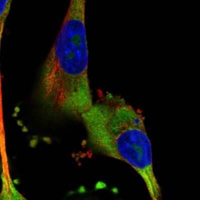 Immunocytochemistry/Immunofluorescence: CRELD1 Antibody [NBP1-88917] - Staining of human cell line U-251 MG shows localization to nucleoli & cytosol. Antibody staining is shown in green.