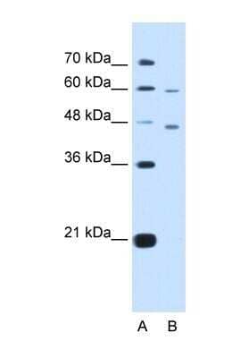 Western Blot: CRELD1 Antibody [NBP1-59928] - HepG2 cell lysate, concentration 5.0ug/ml.