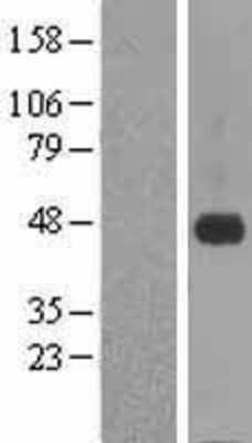 Western Blot: CRELD1 Overexpression Lysate (Adult Normal) [NBL1-09469] Left-Empty vector transfected control cell lysate (HEK293 cell lysate); Right -Over-expression Lysate for CRELD1.