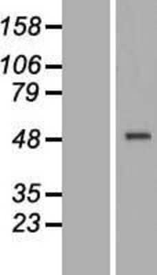 Western Blot: CRELD1 Overexpression Lysate (Adult Normal) [NBP2-07161] Left-Empty vector transfected control cell lysate (HEK293 cell lysate); Right -Over-expression Lysate for CRELD1.