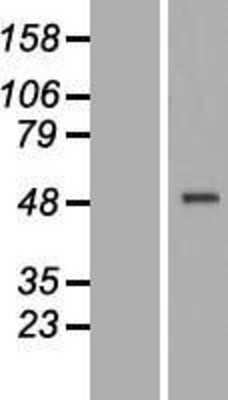 Western Blot: CRELD1 Overexpression Lysate (Adult Normal) [NBP2-09259] Left-Empty vector transfected control cell lysate (HEK293 cell lysate); Right -Over-expression Lysate for CRELD1.