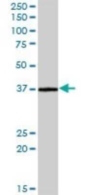 Western Blot: CRELD2 Antibody [H00079174-B01P] - Analysis of CRELD2 expression in human pancreas.