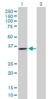 Western Blot: CRELD2 Antibody [H00079174-B01P] - Analysis of CRELD2 expression in transfected 293T cell line by CRELD2 polyclonal antibody.  Lane 1: CRELD2 transfected lysate(35.31 KDa). Lane 2: Non-transfected lysate.