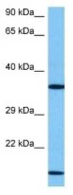 Western Blot: CRELD2 Antibody [NBP3-10820] - Western blot analysis of CRELD2 in Human 786-0 Whole Cell lysates. Antibody dilution at 1ug/ml