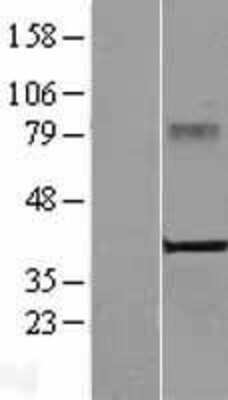 Western Blot: CRELD2 Overexpression Lysate (Adult Normal) [NBL1-09470] Left-Empty vector transfected control cell lysate (HEK293 cell lysate); Right -Over-expression Lysate for CRELD2.