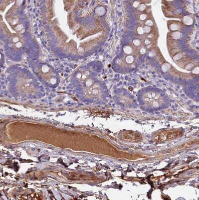 Immunohistochemistry: CRHBP Antibody [NBP1-91811] - Staining of human small intestine shows strong positivity in secretion.