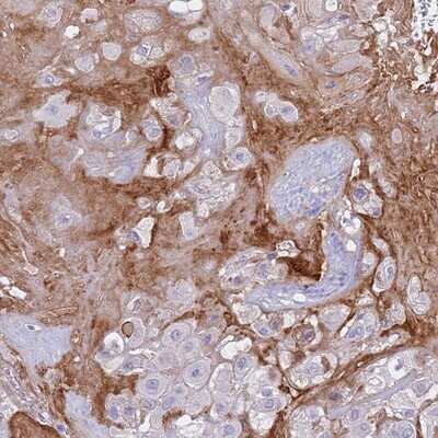 Immunohistochemistry-Paraffin: CRHBP Antibody [NBP1-91811] - Staining of human placenta shows distinct extracellular positivity.