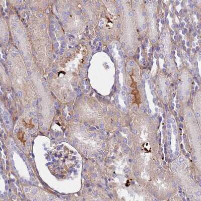 Immunohistochemistry-Paraffin: CRHBP Antibody [NBP1-91811] - Staining of human kidney shows moderate to strong positivity in secretion.