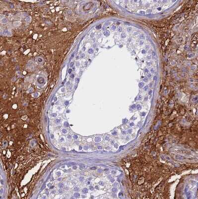 Immunohistochemistry-Paraffin: CRHBP Antibody [NBP1-91811] - Staining of human testis shows strong positivity in secretion.