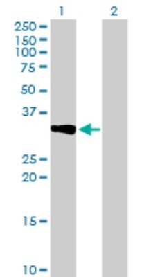 Western Blot: CRHBP Antibody [H00001393-B01P] - Analysis of CRHBP expression in transfected 293T cell line by CRHBP polyclonal antibody.  Lane 1: CRHBP transfected lysate(35.42 KDa). Lane 2: Non-transfected lysate.