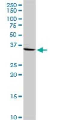 Western Blot: CRHBP Antibody [H00001393-D01P] - Analysis of CRHBP expression in human colon.