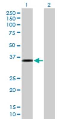 Western Blot: CRHBP Antibody [H00001393-D01P] - Analysis of CRHBP expression in transfected 293T cell line by CRHBP polyclonal antibody.Lane 1: CRHBP transfected lysate(36.10 KDa).Lane 2: Non-transfected lysate.