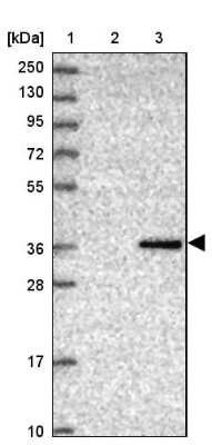 Western Blot: CRHBP Antibody [NBP1-91811] - Lane 1: Marker  [kDa] 250, 130, 95, 72, 55, 36, 28, 17, 10.  Lane 2: Human cell line RT-4.  Lane 3: Human cell line U-251MG sp