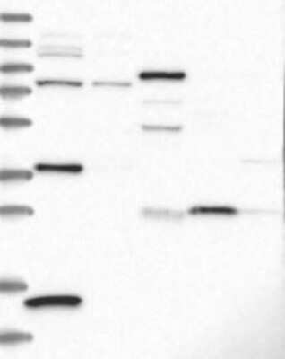 Western Blot: CRHBP Antibody [NBP3-17697] - Lane 1: Marker [kDa] 230, 130, 95, 72, 56, 36, 28, 17, 11;   Lane 2: RT4;   Lane 3: U-251 MG;   Lane 4: Human Plasma;   Lane 5: Liver;   Lane 6: Tonsil